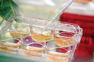 راه اندازی دستگاه میکروسکوپ جراحی در کلینیک ارولوژی پژوهشکده علوم تولیدمثل یزد 